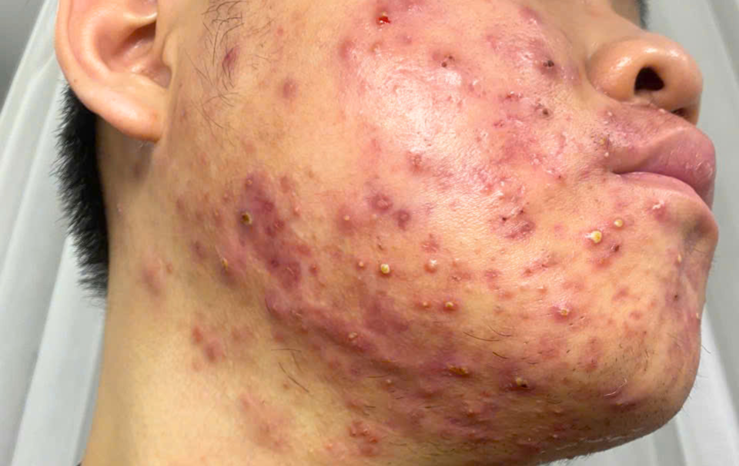 Trước