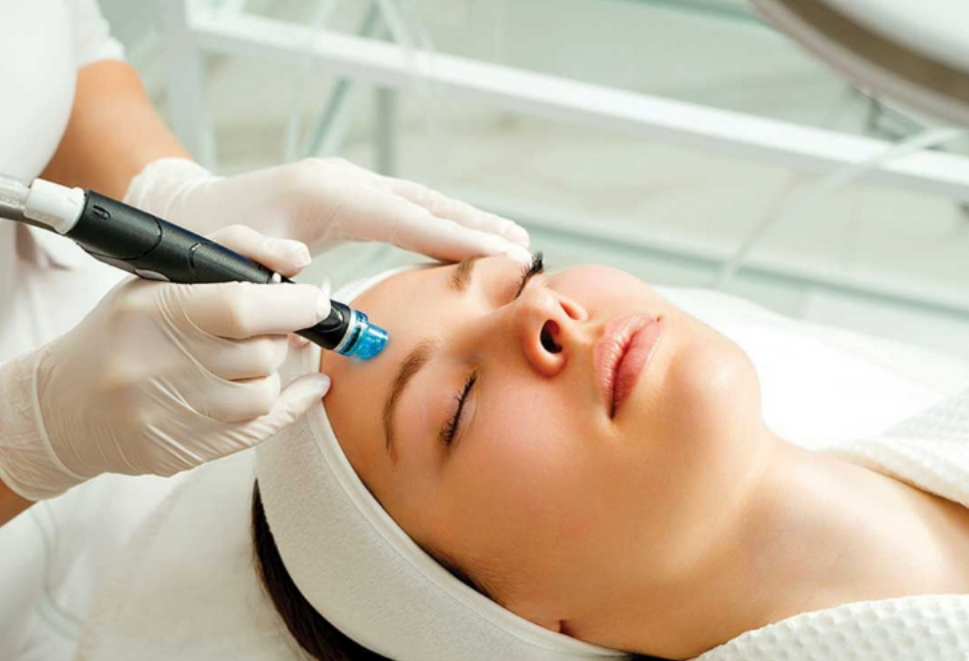 Laser toning trị mụn