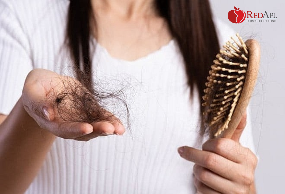 Phân biệt rụng tóc sinh lý & bệnh lý