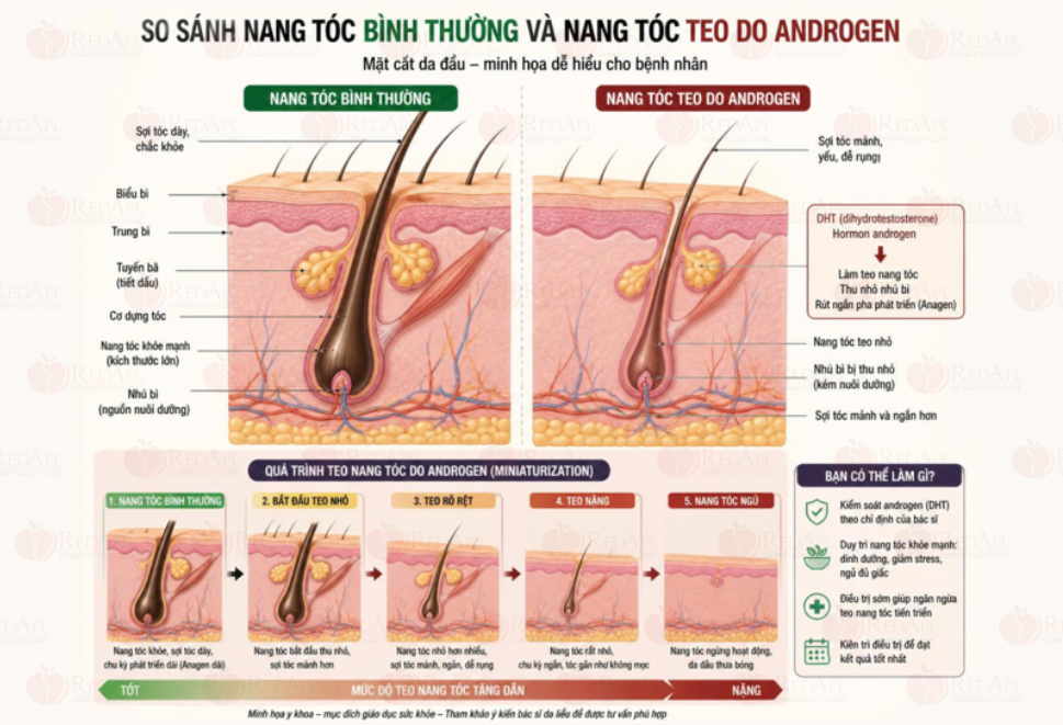 androgen