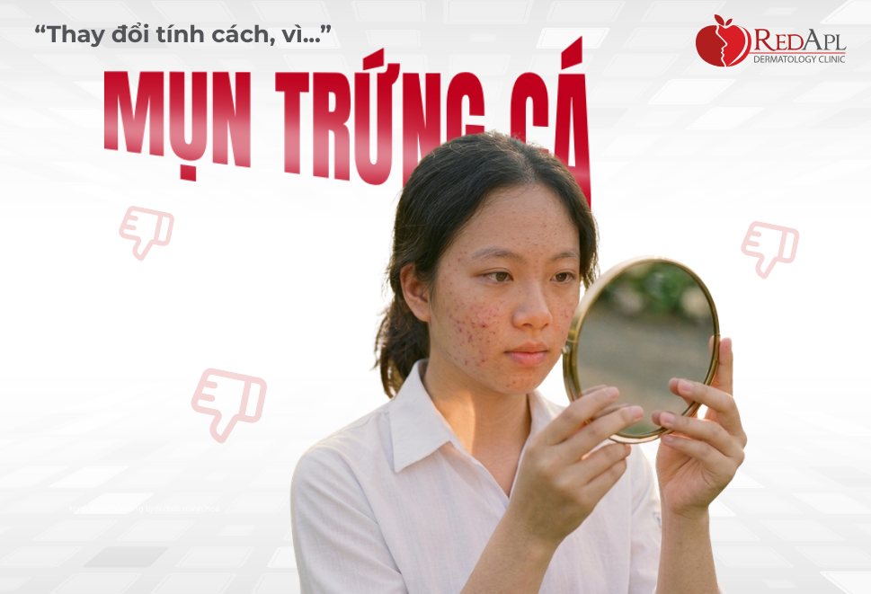 Mụn Trứng Cá Có Thể Khiến Bạn Thay Đổi Tính Cách?