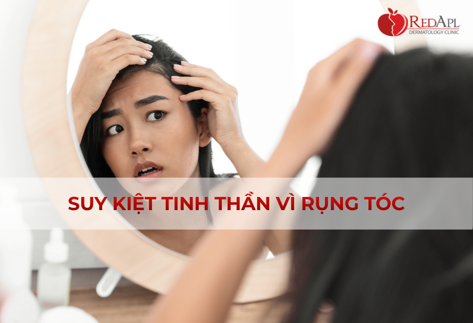 Suy Kiệt Tinh Thần Vì Rụng Tóc